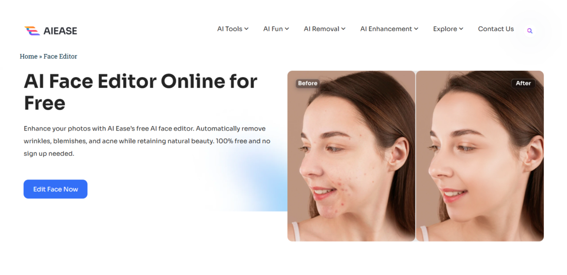 How to Clear Face Acne Online for Free